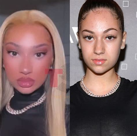 Bhad Bhabie reveals what plastic surgery shes had done to